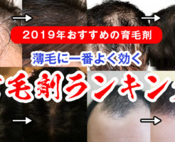 2019年オススメの育毛剤ランキング